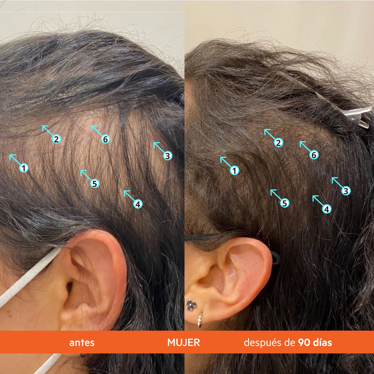 DS LABS Revita® Acondicionador anticaída estimulante del cabello