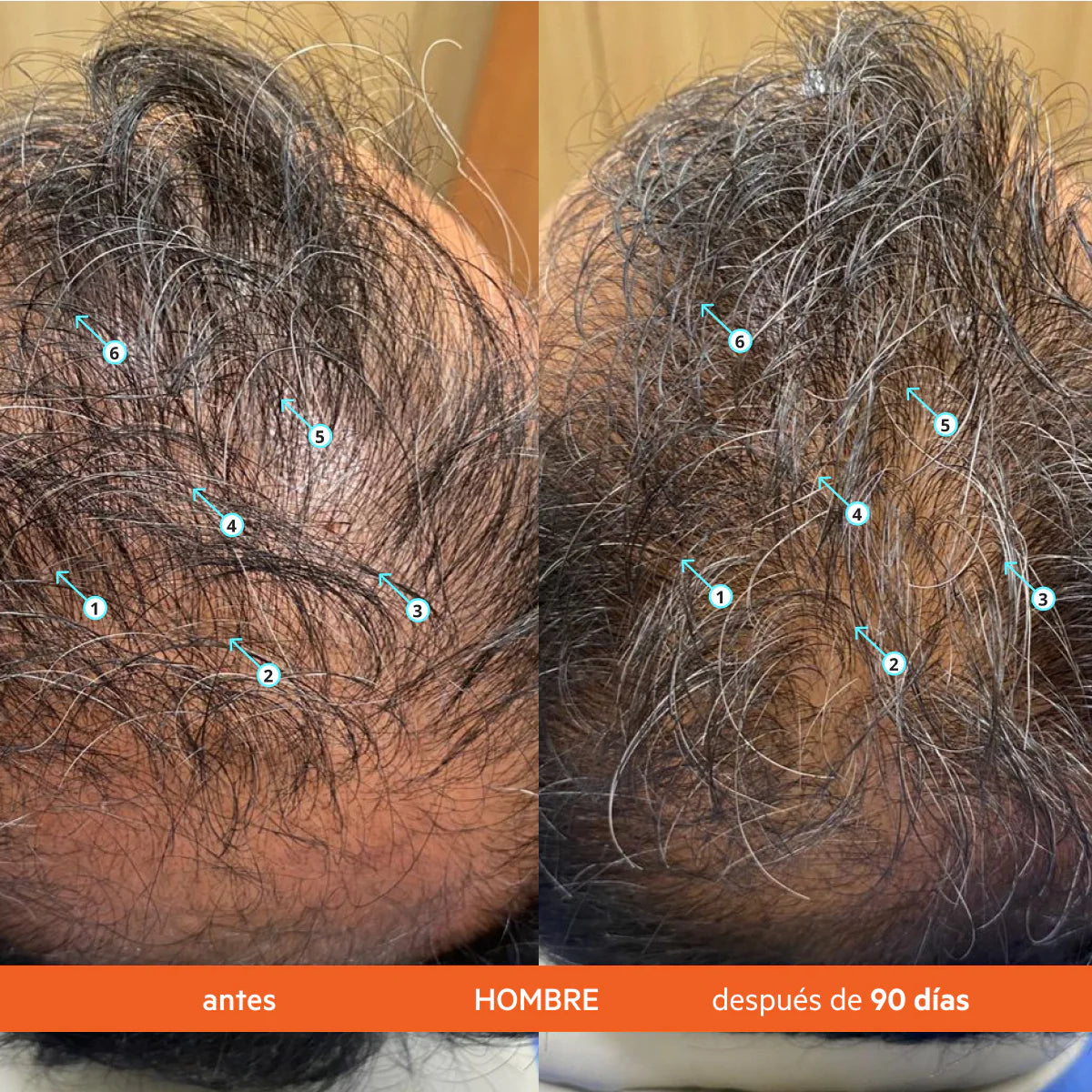 DS LABS Revita® Acondicionador anticaída estimulante del cabello