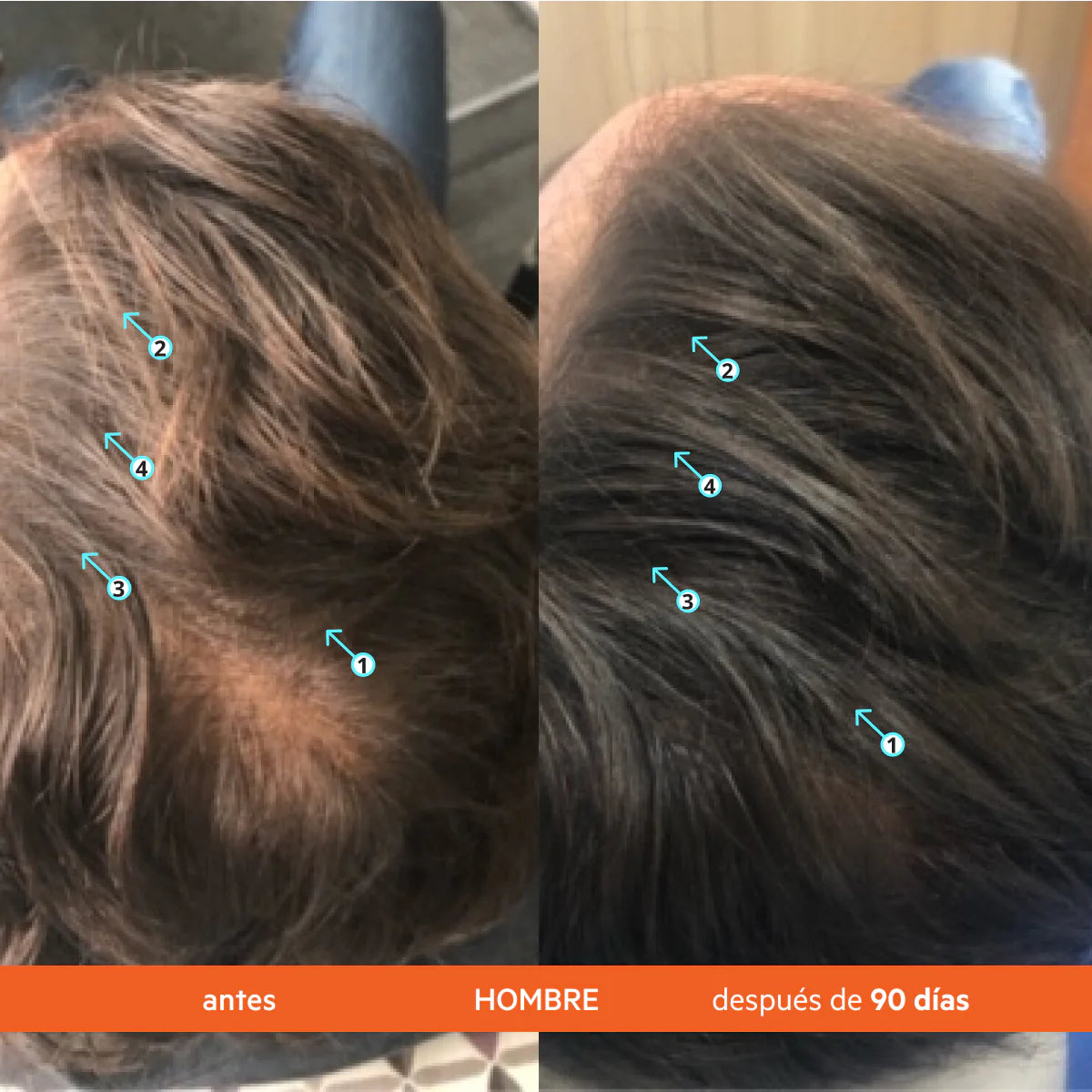 DS LABS Revita® Acondicionador anticaída estimulante del cabello