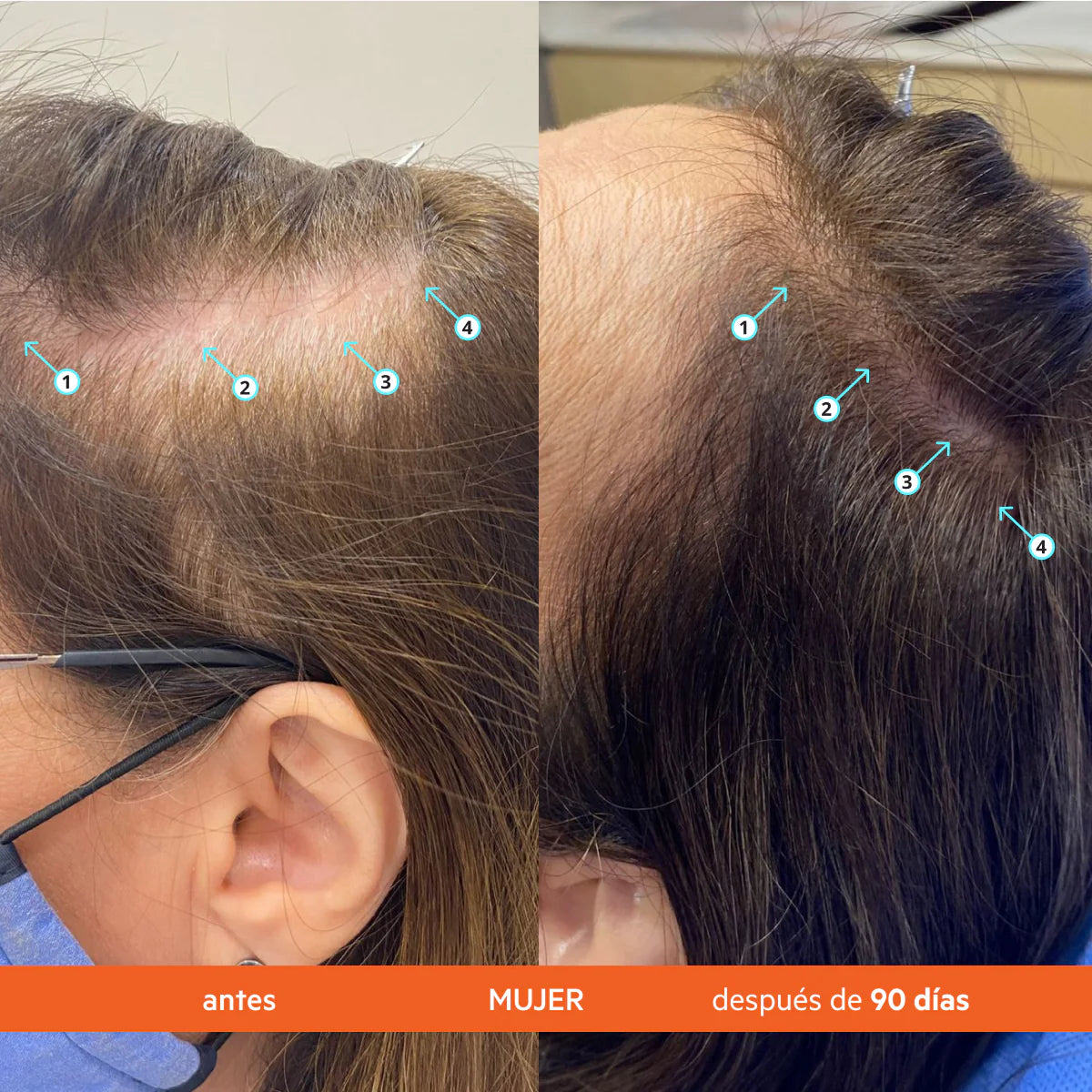 DS LABS Revita® Acondicionador anticaída estimulante del cabello