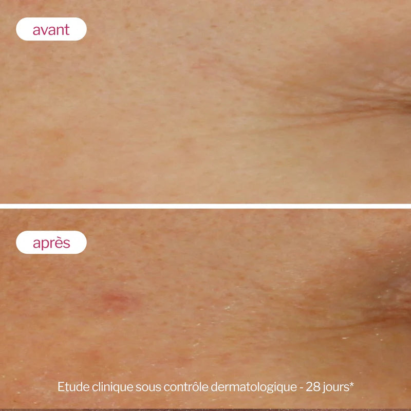 NOVEXPERT Sérum Booster 3,2% Ácido Hialurónico 30ml
