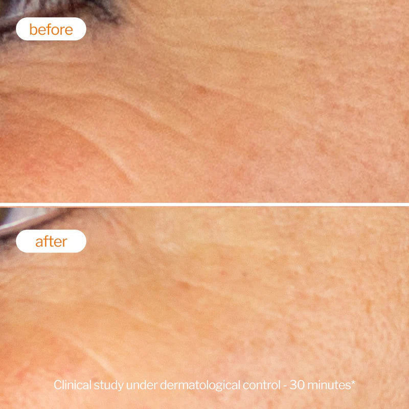 NOVEXPERT Vitamin C Booster