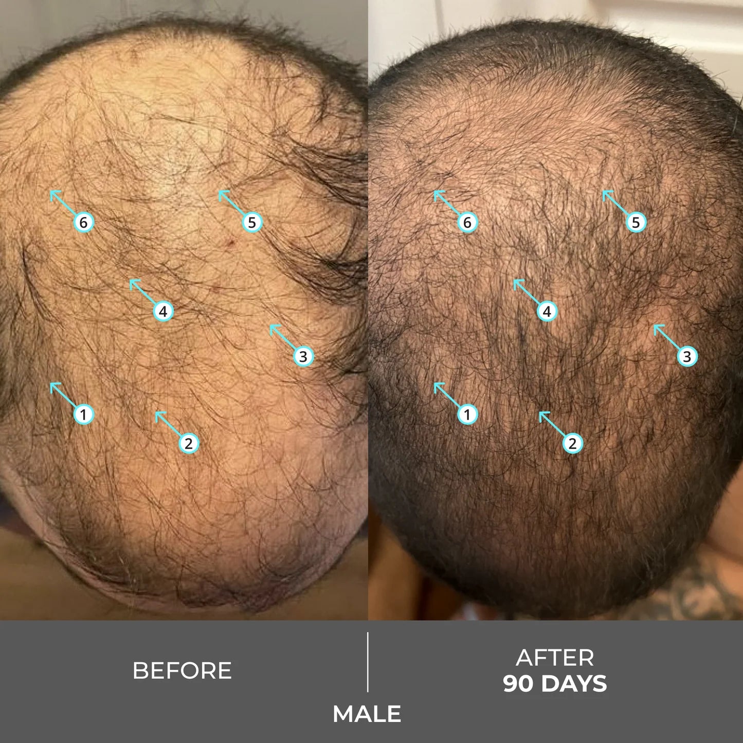 Revita Extra Strength Hair DENSITY Shampoo