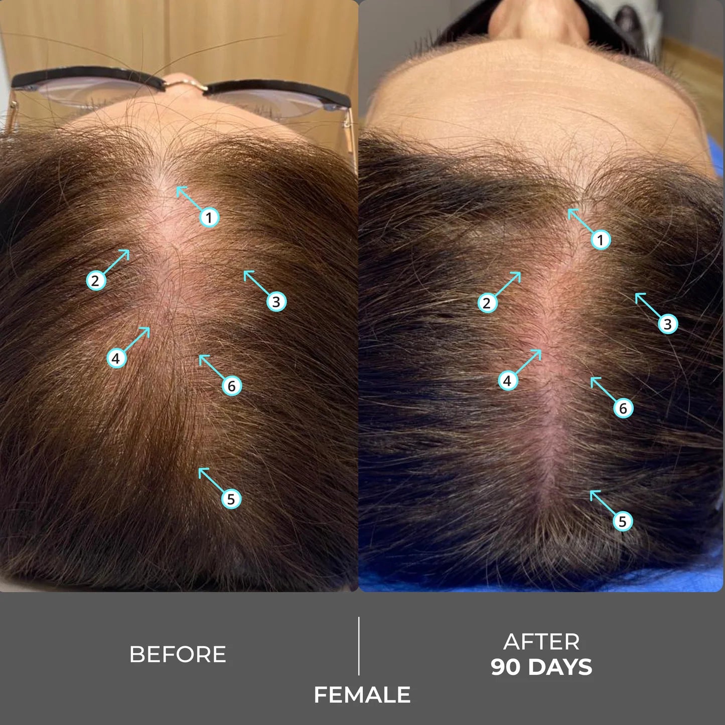 Revita Extra Strength Hair DENSITY Shampoo