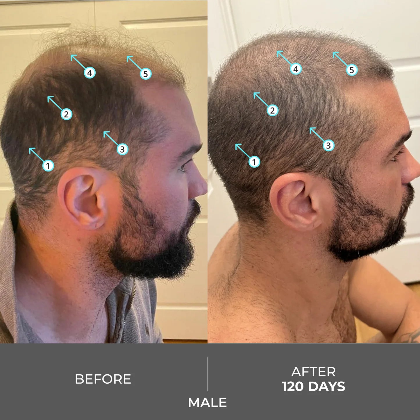 Revita Extra Strength Hair DENSITY Shampoo