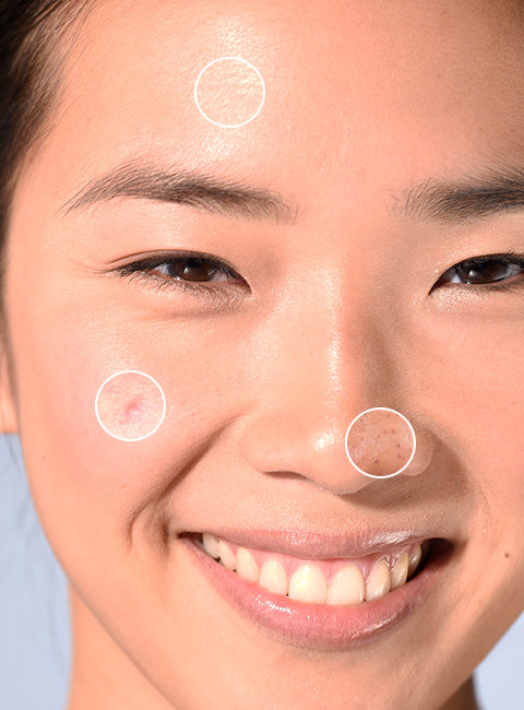 Teen Derm Gel